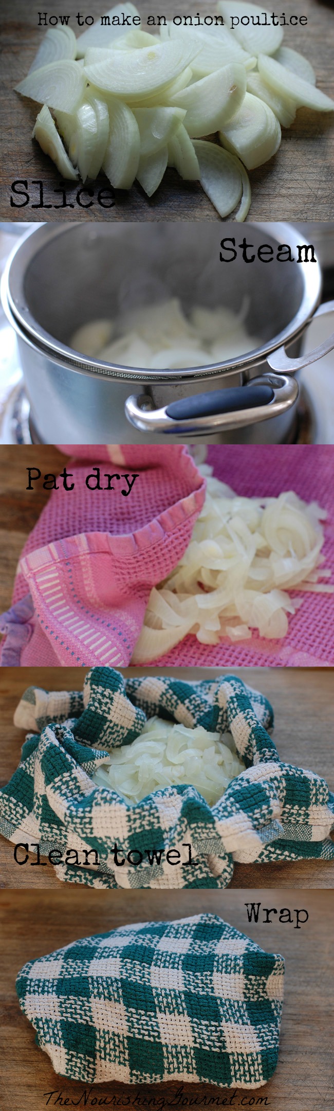 How to make an onion poultice (traditionally used for coughs and chest congestion)